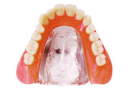 コバルトブログ義歯