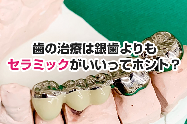歯の治療は銀歯よりもセラミックがいいってホント？