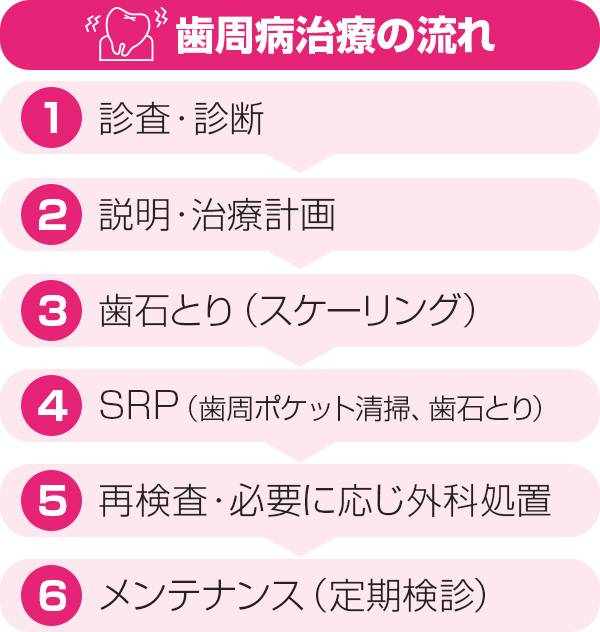 歯周病治療の流れ